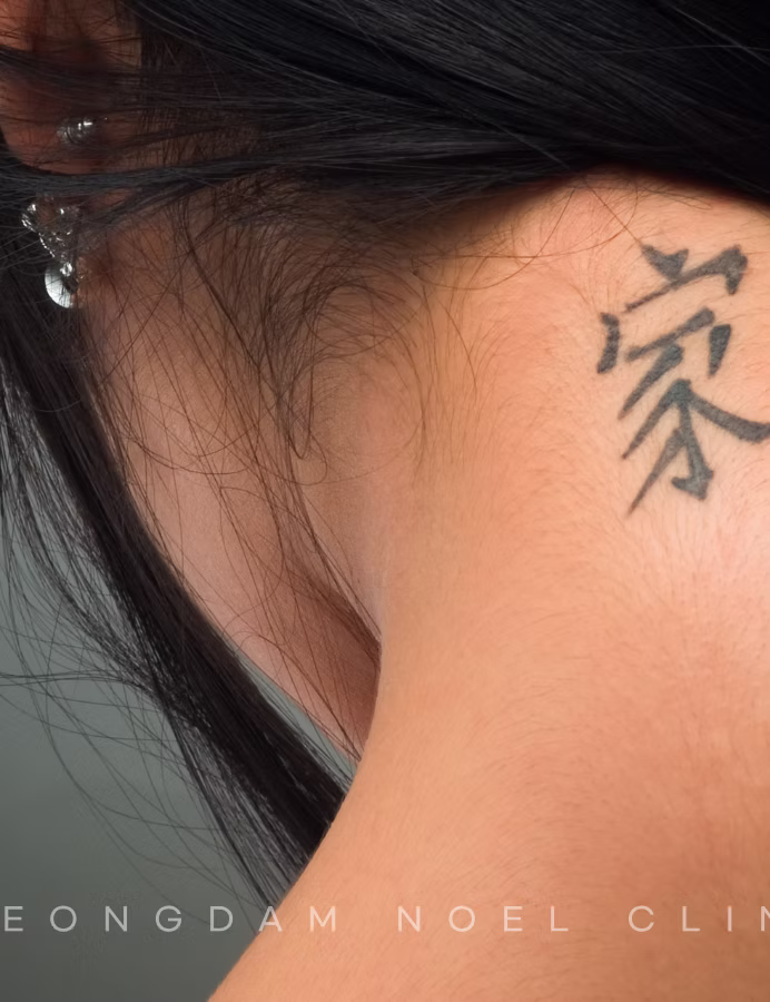 청담노엘의원 Offering