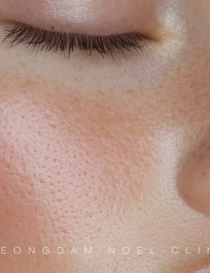 청담노엘의원 Offering