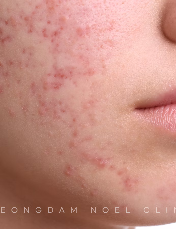 청담노엘의원 Offering