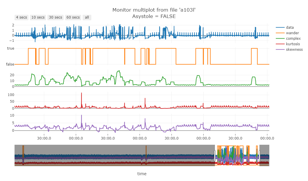 Green line is the "complexity" of the signal.