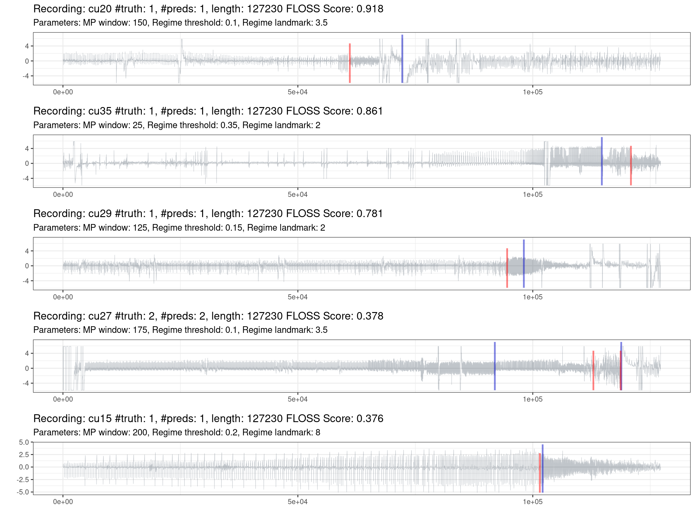 Prediction of the worst 10% of recordings (red is the truth, blue are the predictions).