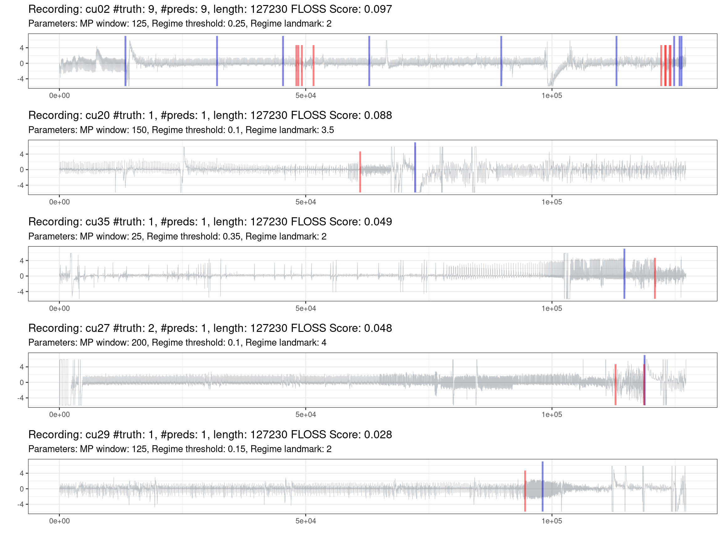 Prediction of the worst 10% of recordings (red is the truth, blue are the predictions).