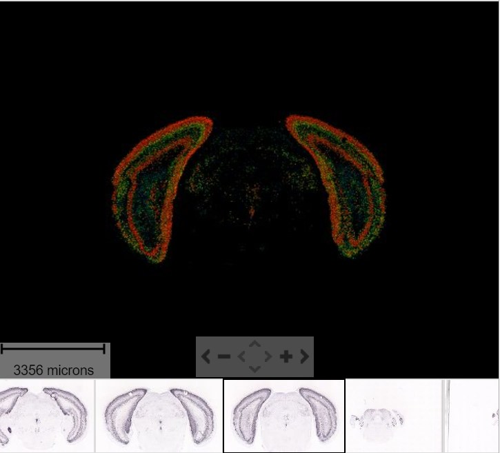 Expression data - Allen brain atlas