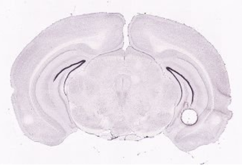 ISH data - Allen brain atlas