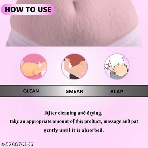 Drybins Stretch Mark Cream For Women For Scars, Stretch Mark, Ageing, Uneven Skin Tone, Firming & Nourishment Stretch mark remove Cream Pack of 1 - Anuloria 