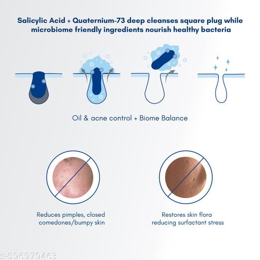 Face Wash for Oily Skin | Airy face wash for Man & Woman | Non-drying, Soap & Sulphate free | Oil, Acne, Dullness, Pore control | Microbiome friendly | With Quaternium - 73 & Prebiotic | No fragrance - Aurafashion
