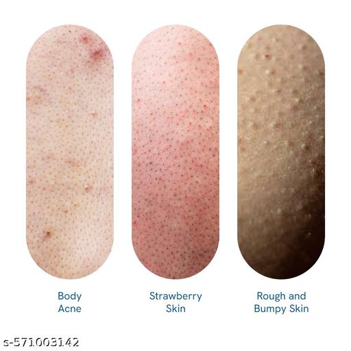 1% Salicylic Acid Body Wash 100ml  | Prevents Body Acne & Exfoliates Skin - Aurafashion