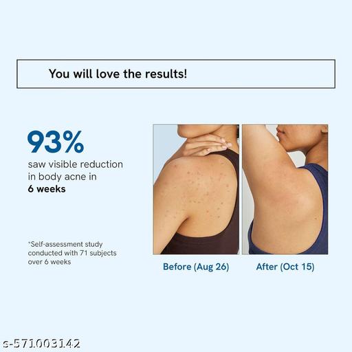 1% Salicylic Acid Body Wash 100ml  | Prevents Body Acne & Exfoliates Skin - Aurafashion