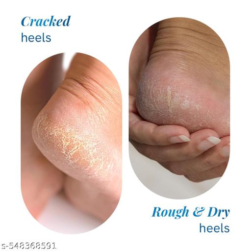 20% Urea Foot Roll On 50ml | For Dry & Cracked Heels - Piktocart