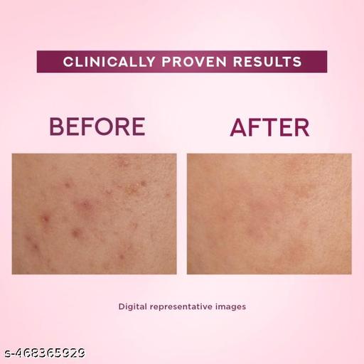 Bright Beauty Anti-Spot Serum Cream _ 35g - ZORA